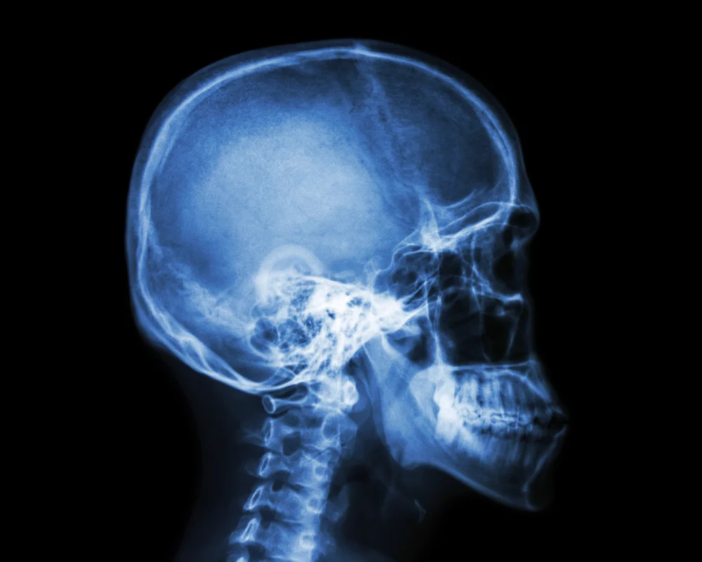 x-rays.jpg