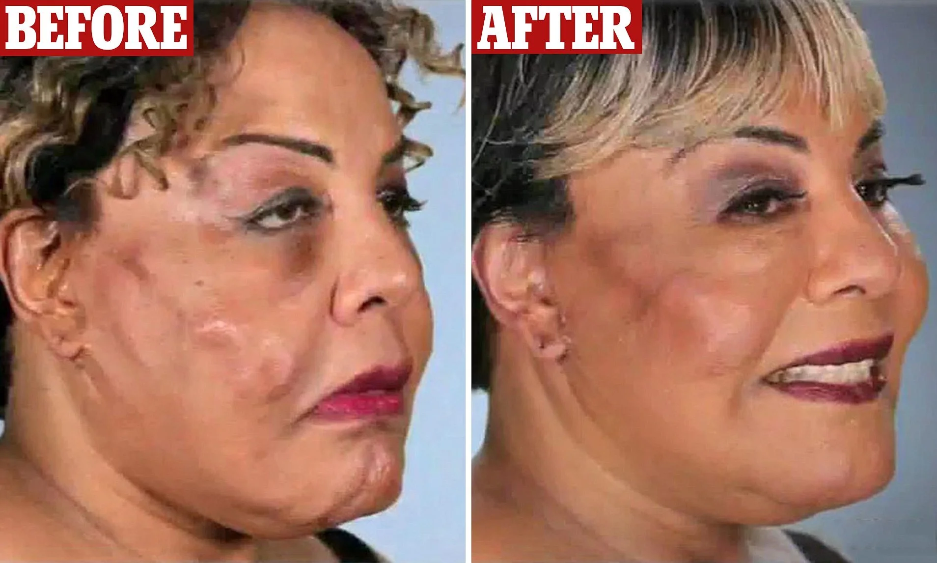 The Daily Dropout — Plastic Surgery Horror Stories