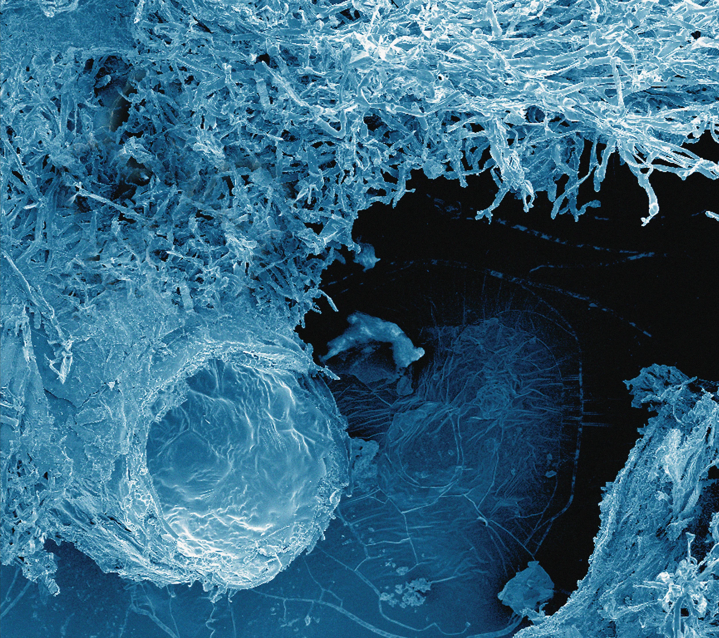 The fungal superhighway: soil fungi colonise different areas in the soil, often depending on the associations they have with plants growing aboveground. Image credit: http://flic.kr/p/dpRSsP .