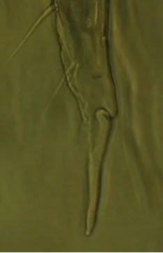 Above: Xenylla humicola mucro-dens junction