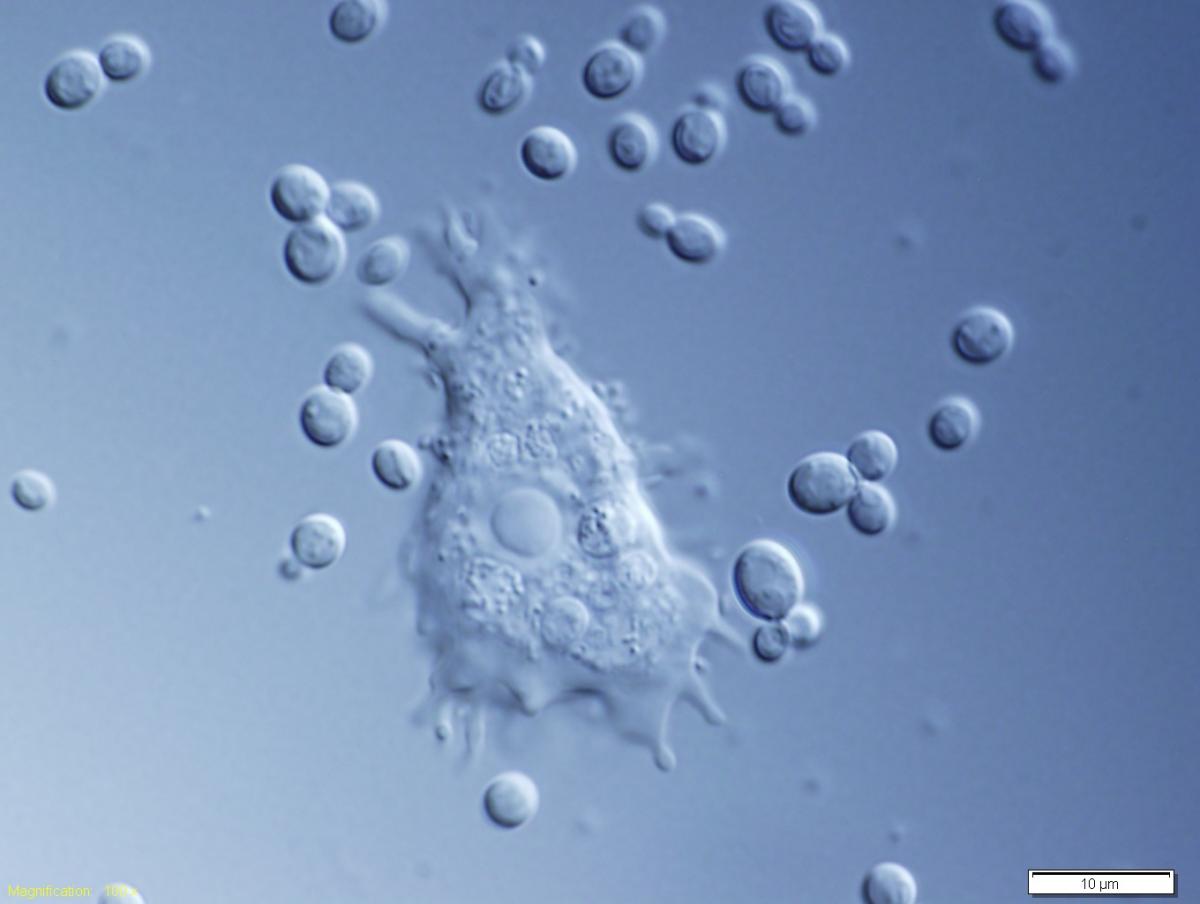 Figure 1: This unidentified amoeba is one of the members of the extremely diverse protist community inhabiting the soil of a common indoor flower pot; new species can be found even in the least exotic environments! This species feeds on yeasts and bacteria.