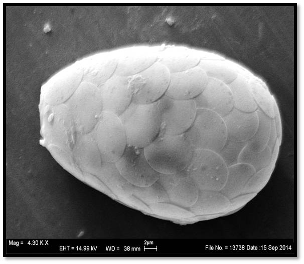 Testate amoebae Tracheleuglypha