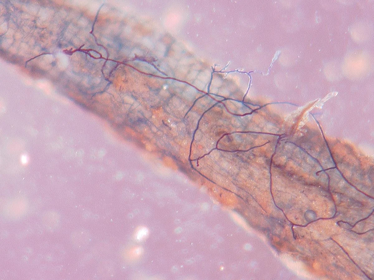 Root with mycorrhizal fungi. Photo credit A. Cobb