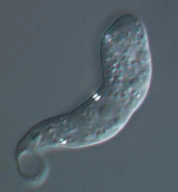 Saccamoeba. Image from S. Geisen