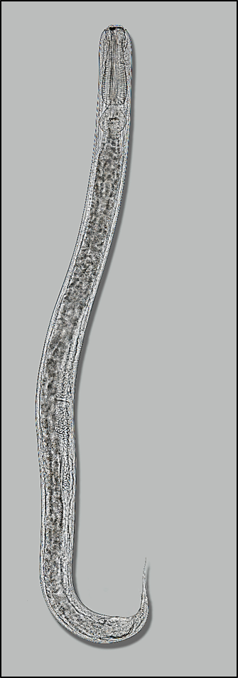 Rhigonema sp. – a common nematode found in numerous species of millipedes. Photo courtesy of Dr. Jon Eisenback