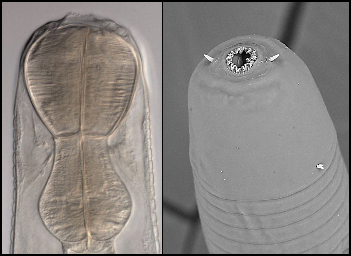 Coronostoma claireae (a predatory nematode) – DIC image on left and SEM on right. Note the lack of a grinding valve, the muscular esophagus, very large first annule and the projecting, conical amphids.