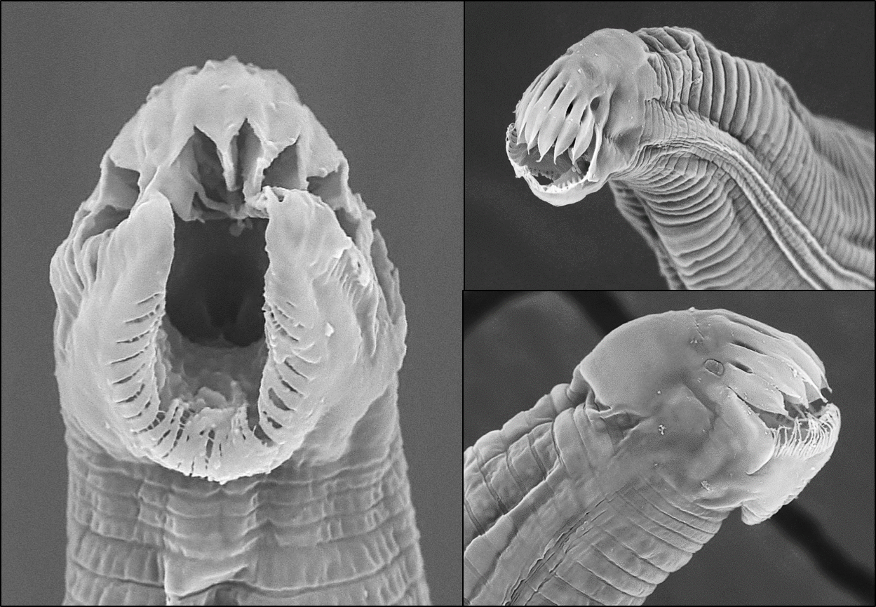 Golovatchinema sp. – SEM of the 3rd stage juvenile. This juvenile stage bears no resemblance to the adults.