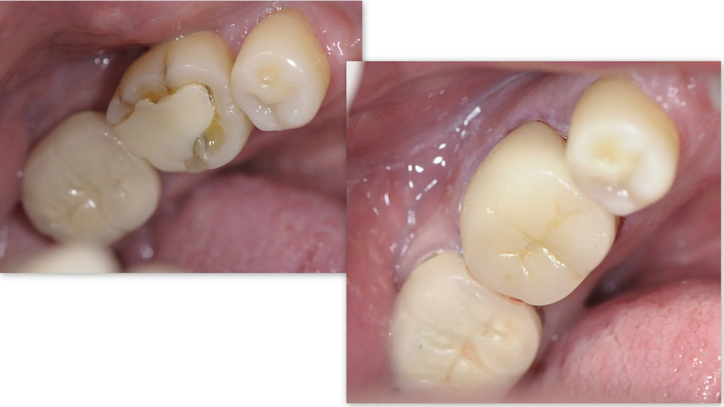 Before & After Dental Image