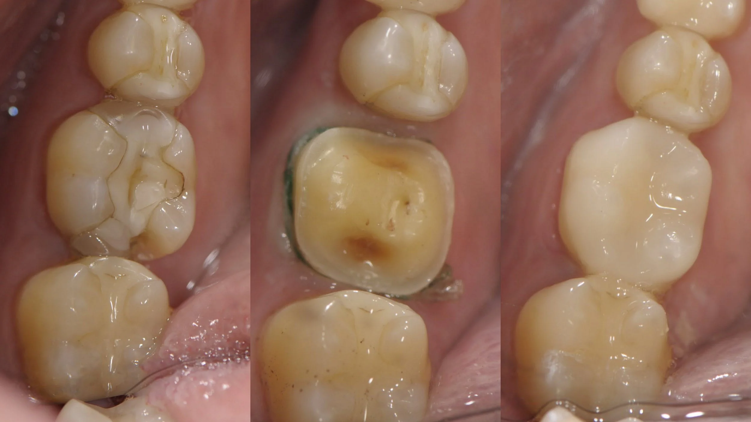 Before & After Dental Image
