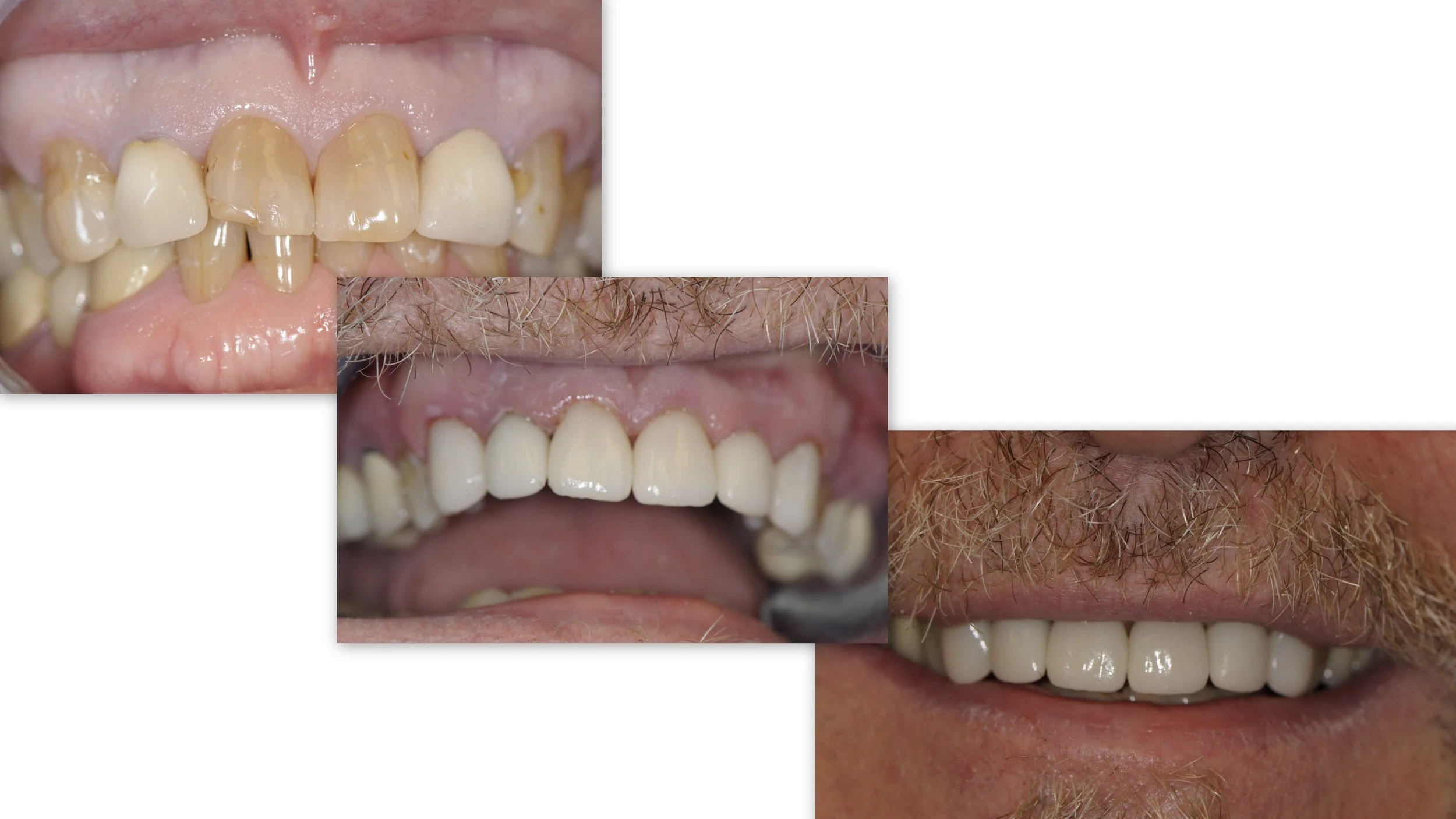 Before & After Dental Image