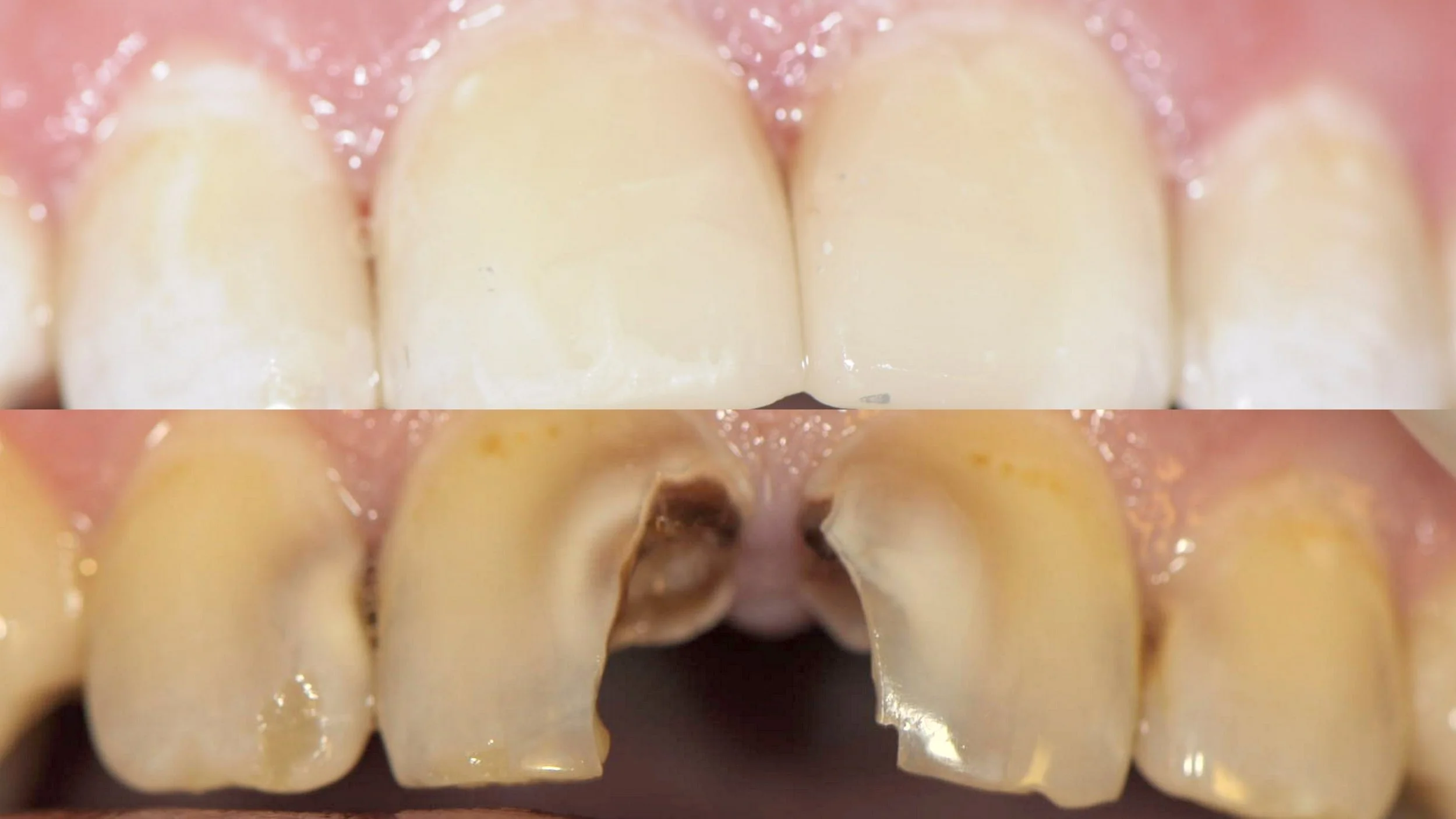 Before & After Dental Image