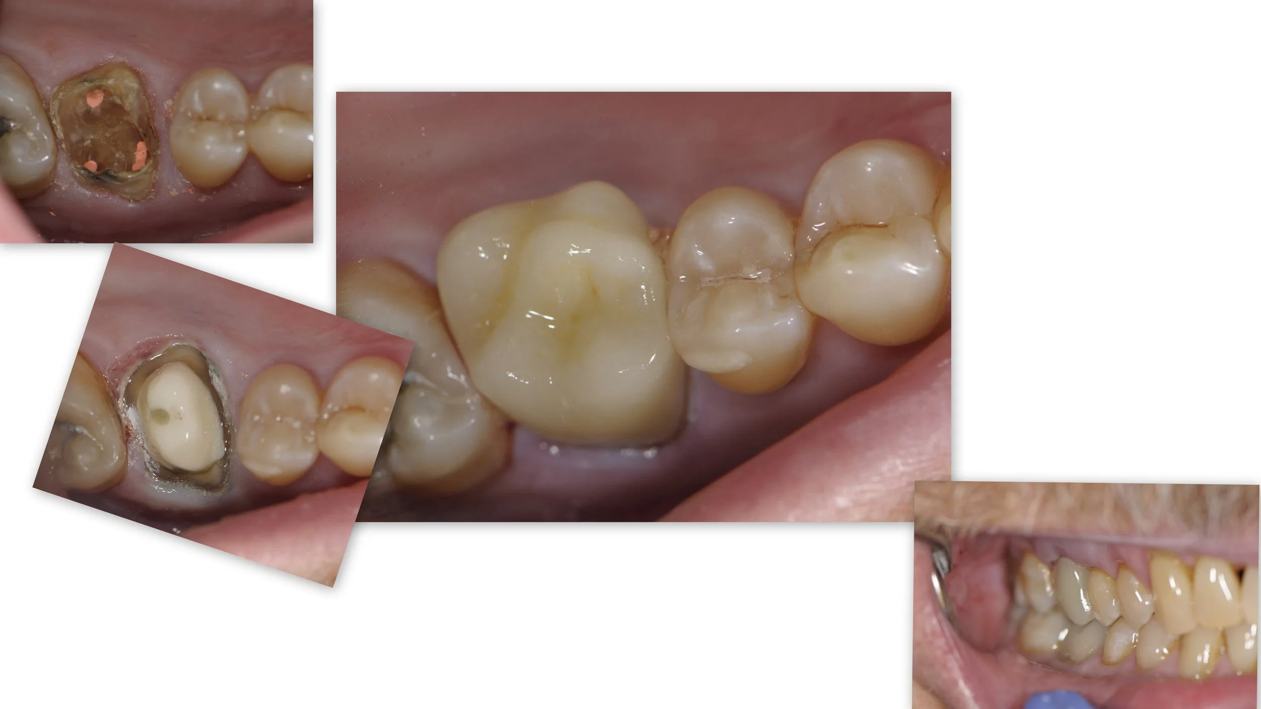 Before & After Dental Image
