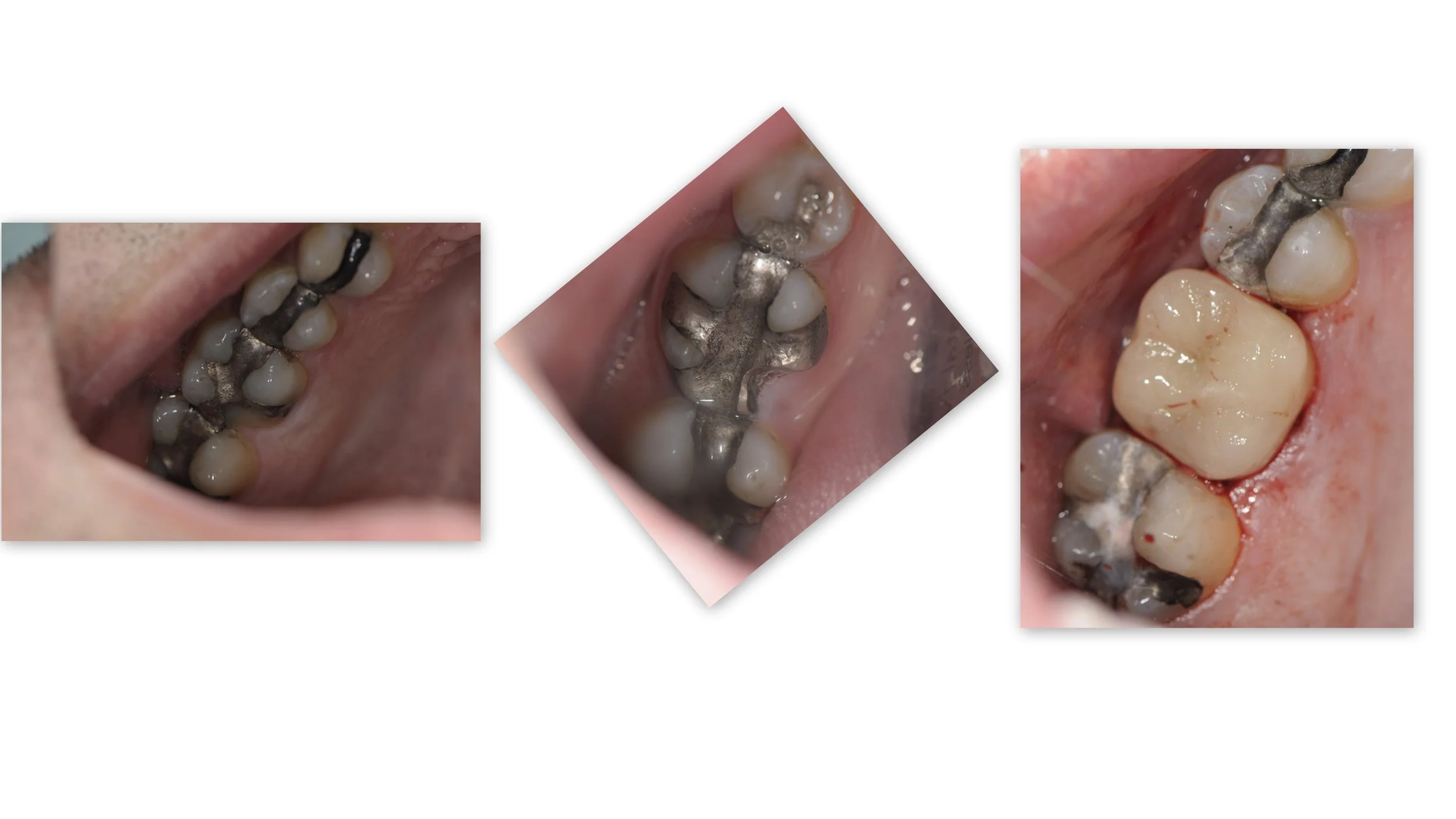 Before & After Dental Image
