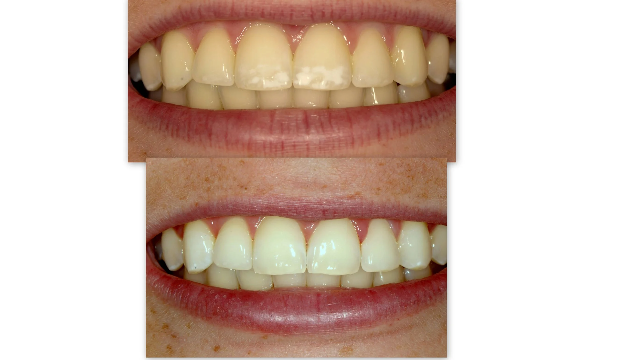Before & After Dental Image