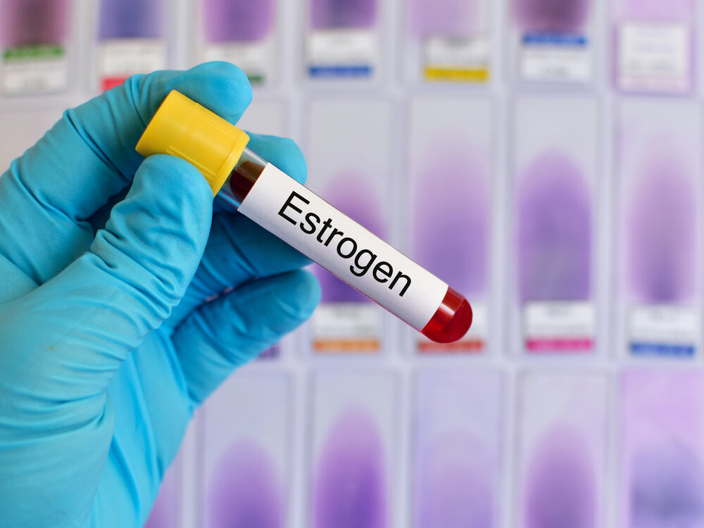 Blood sample for estrogen (female hormone) testing