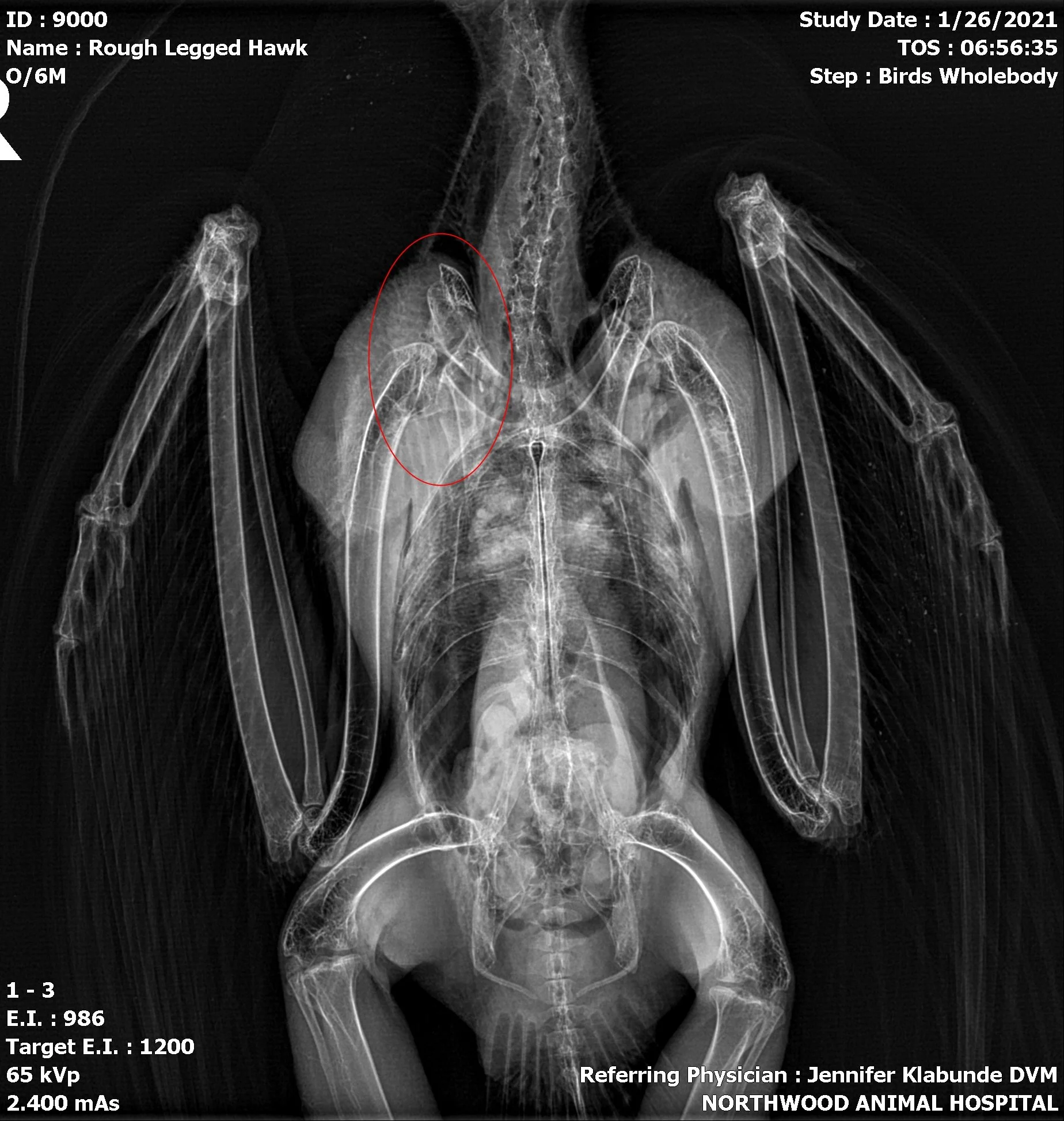 Rehabilitation & Release | Support Raptor Recovery Today — North Sky ...
