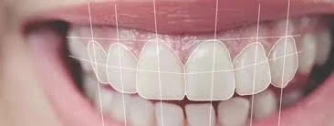 ¿Por qué todos hablan del diseño de sonrisa?