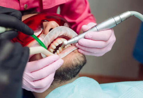 contraste Vulgaridad Gimnasio Cuánto dura una limpieza dental? — Odontologic
