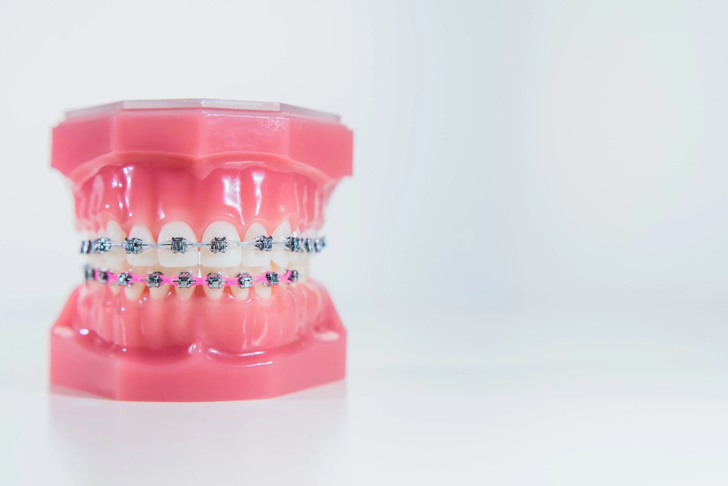 ¿Cuántos tipos de brackets existen?