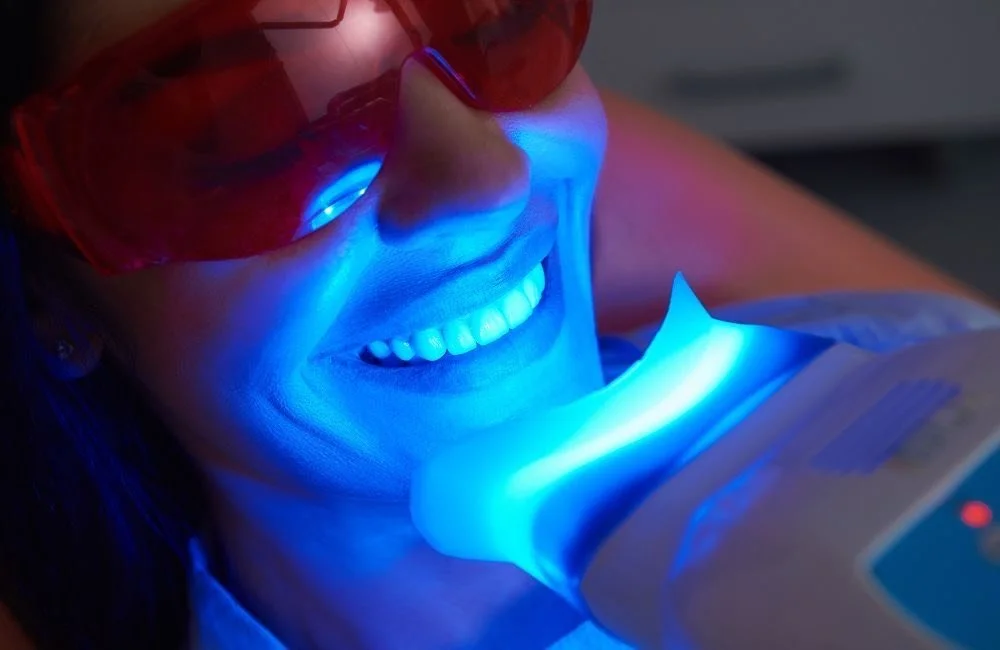 El Blanqueamiento Dental con Zoom: Un Procedimiento Revolucionario en la Estética Dental
