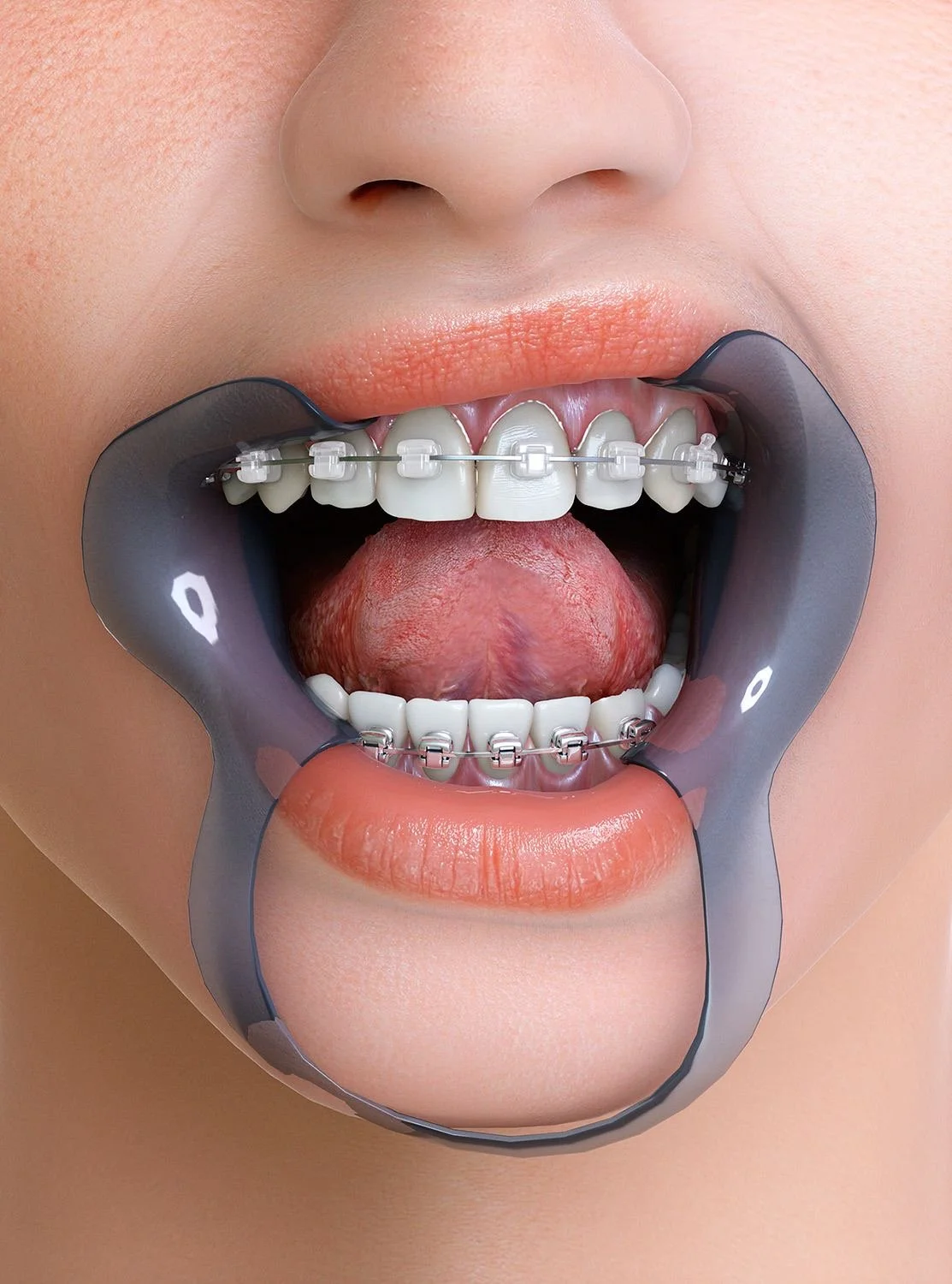 Rehabilitación Oral Completa: Estrategias Multidisciplinarias para Recuperar la Funcionalidad y Estética