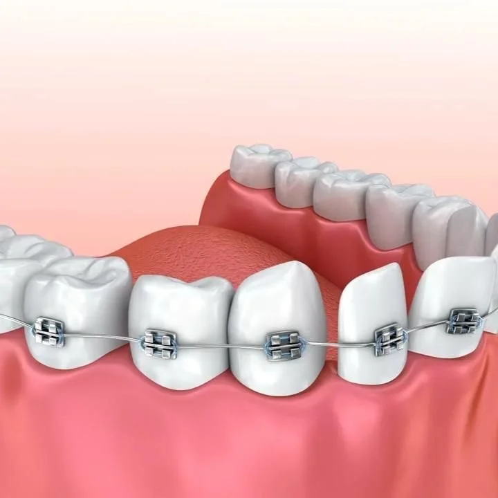 La Inteligencia Artificial en el Diagnóstico Dental: Cómo los Algoritmos Mejoran la Precisión y Reducción de Errores Médicos