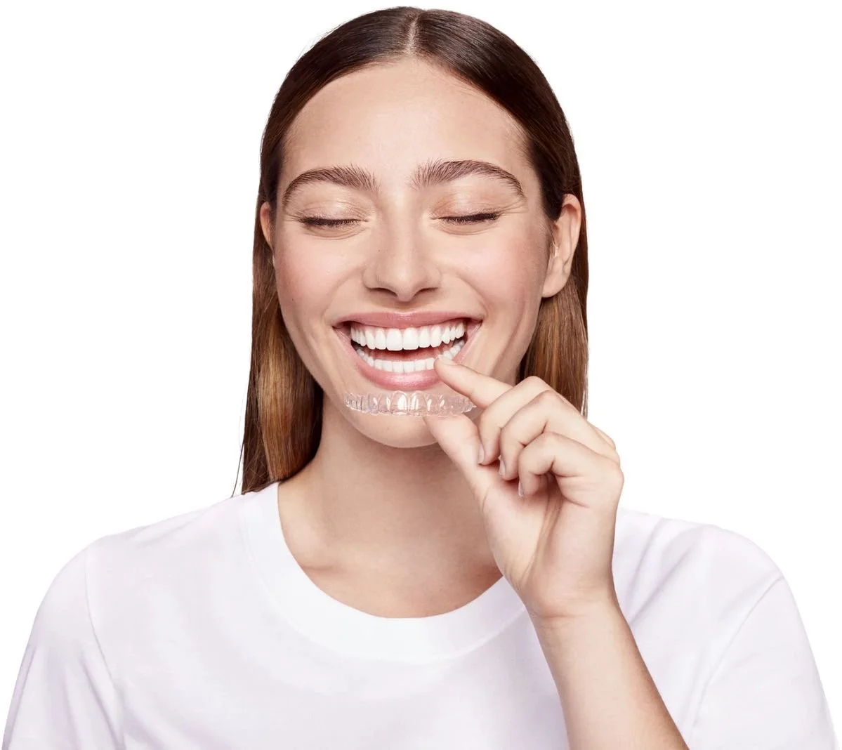 ¿Se puede tomar café con los alineadores puestos? Una mirada profunda desde la ortodoncia estética