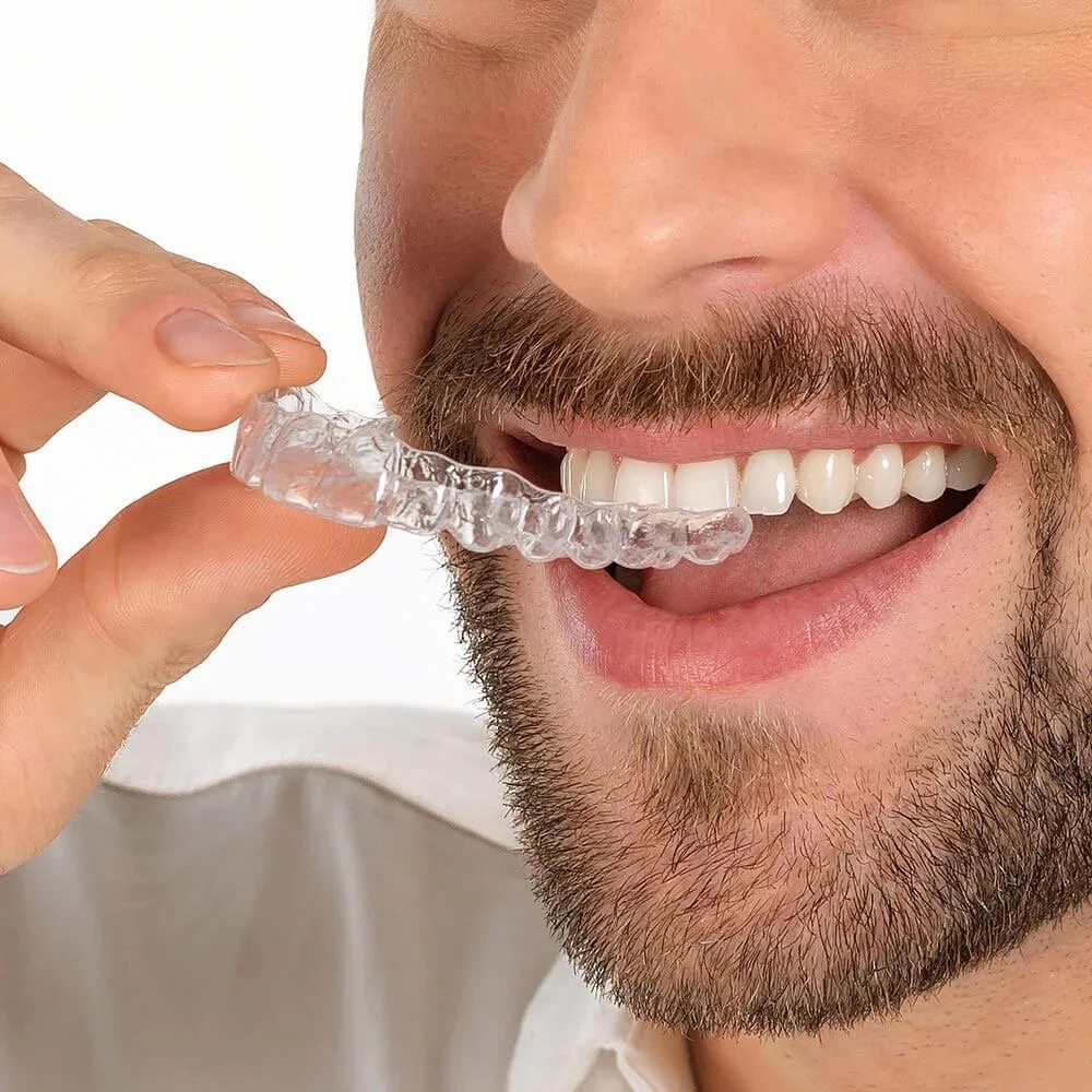 Invisalign en adultos: beneficios, tiempos y resultados reales