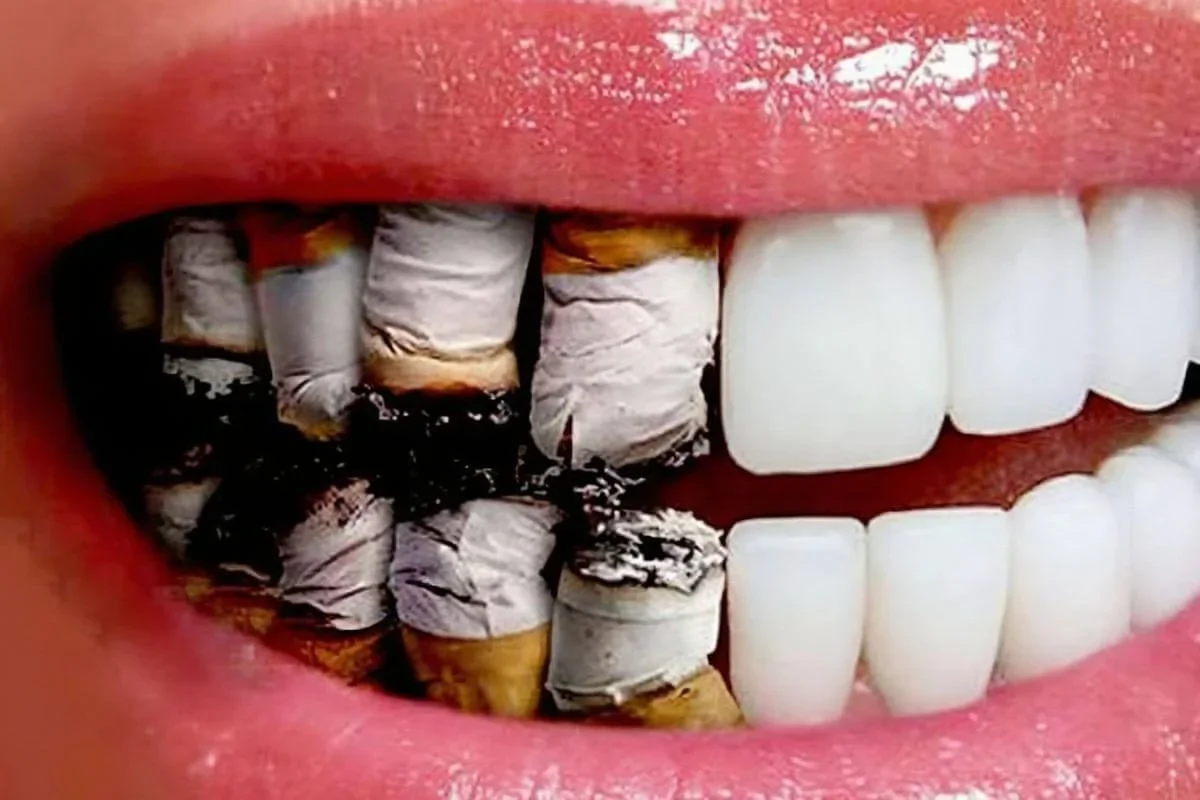 Lo que el cigarro le hace a tu boca: más allá de los dientes amarillos