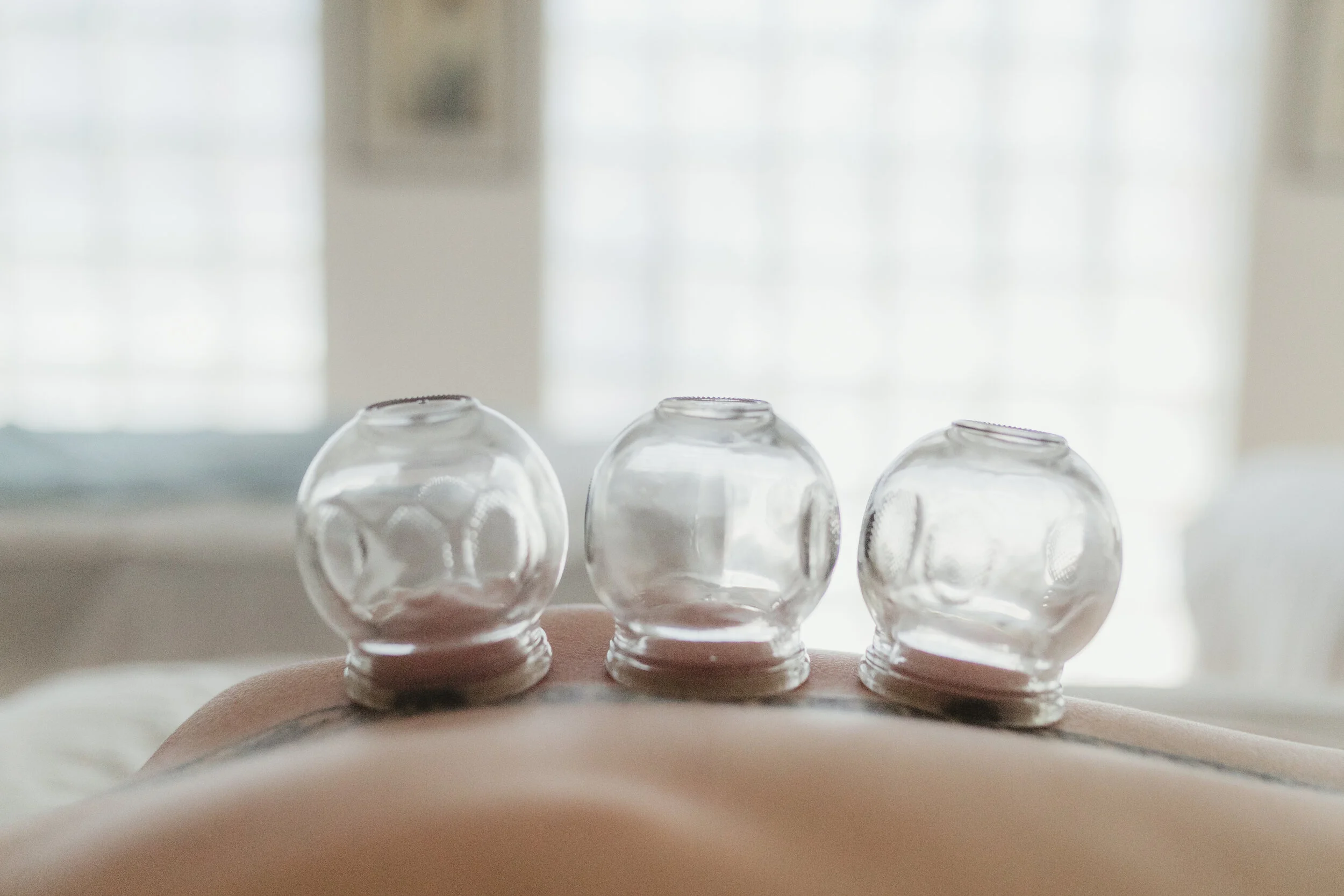 DENVER ACUPUNCTURE LOUNGE Cupping Therapy