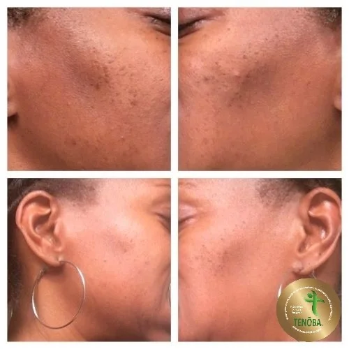 Client Using Face Nurturing System