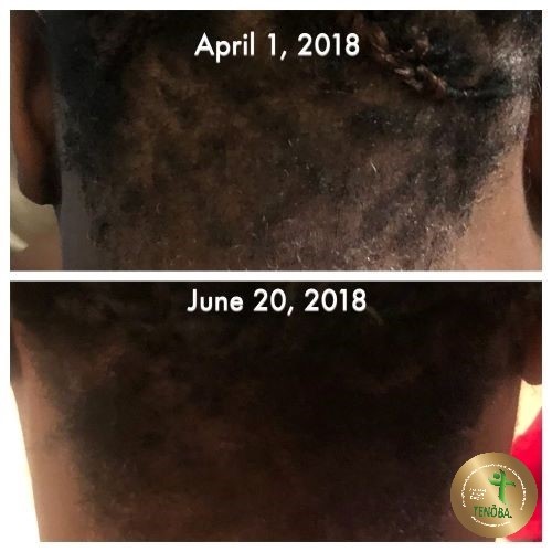 Client Using Hair Serum