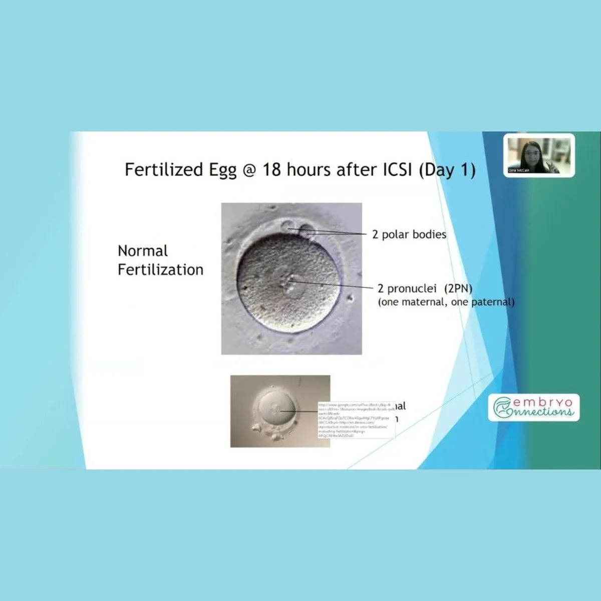 Embryo Grading Explained: How Embryos Are Graded and Selected