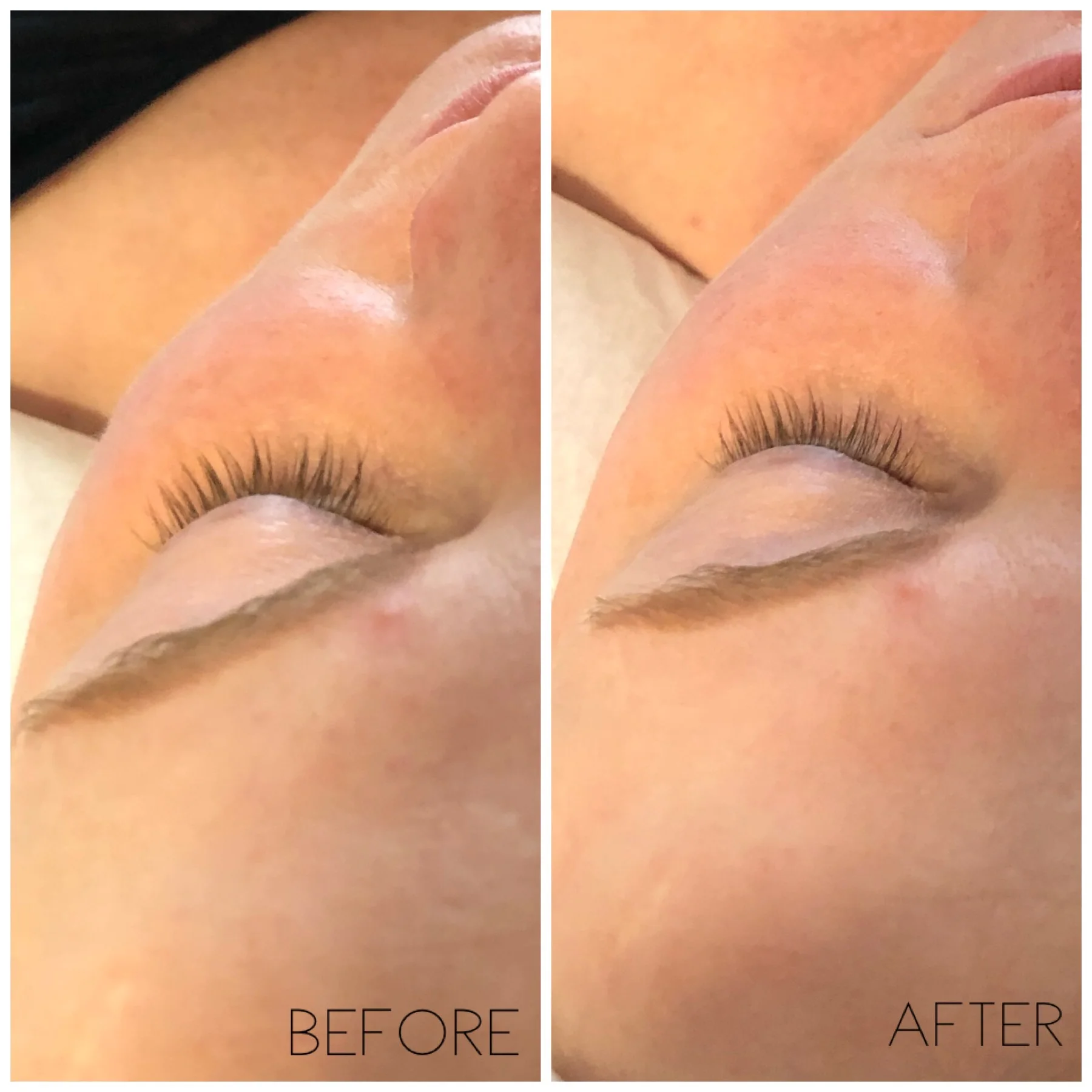 Face Sculpting Massage: Natural FaceLift