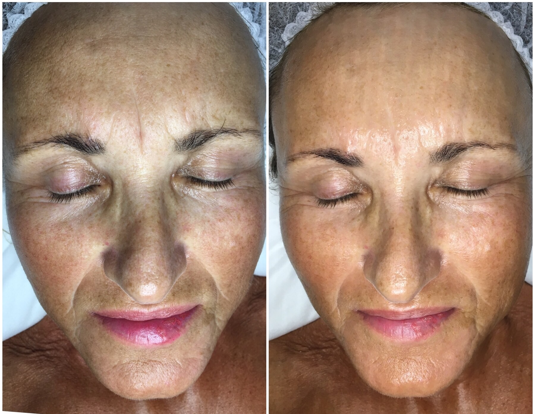 Create a facelift using only makeup: Here's how