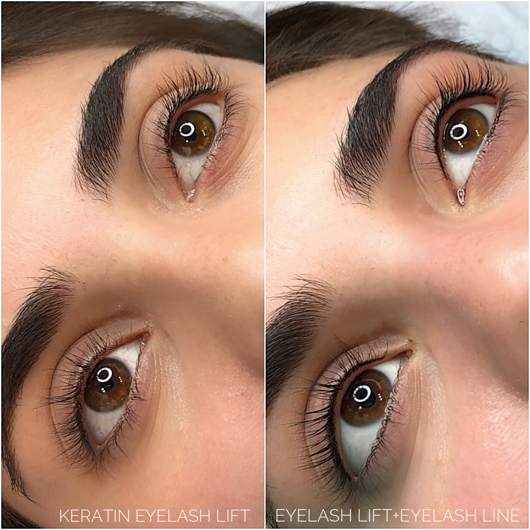 Lash Enhancement, or Invisible Eyeliner — AskCares