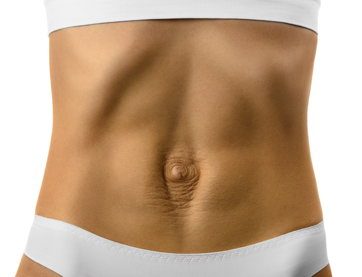 Diastasis Rectus Abdominis 101: All About The Mummy Tummy — Ladner  Village Physiotherapy