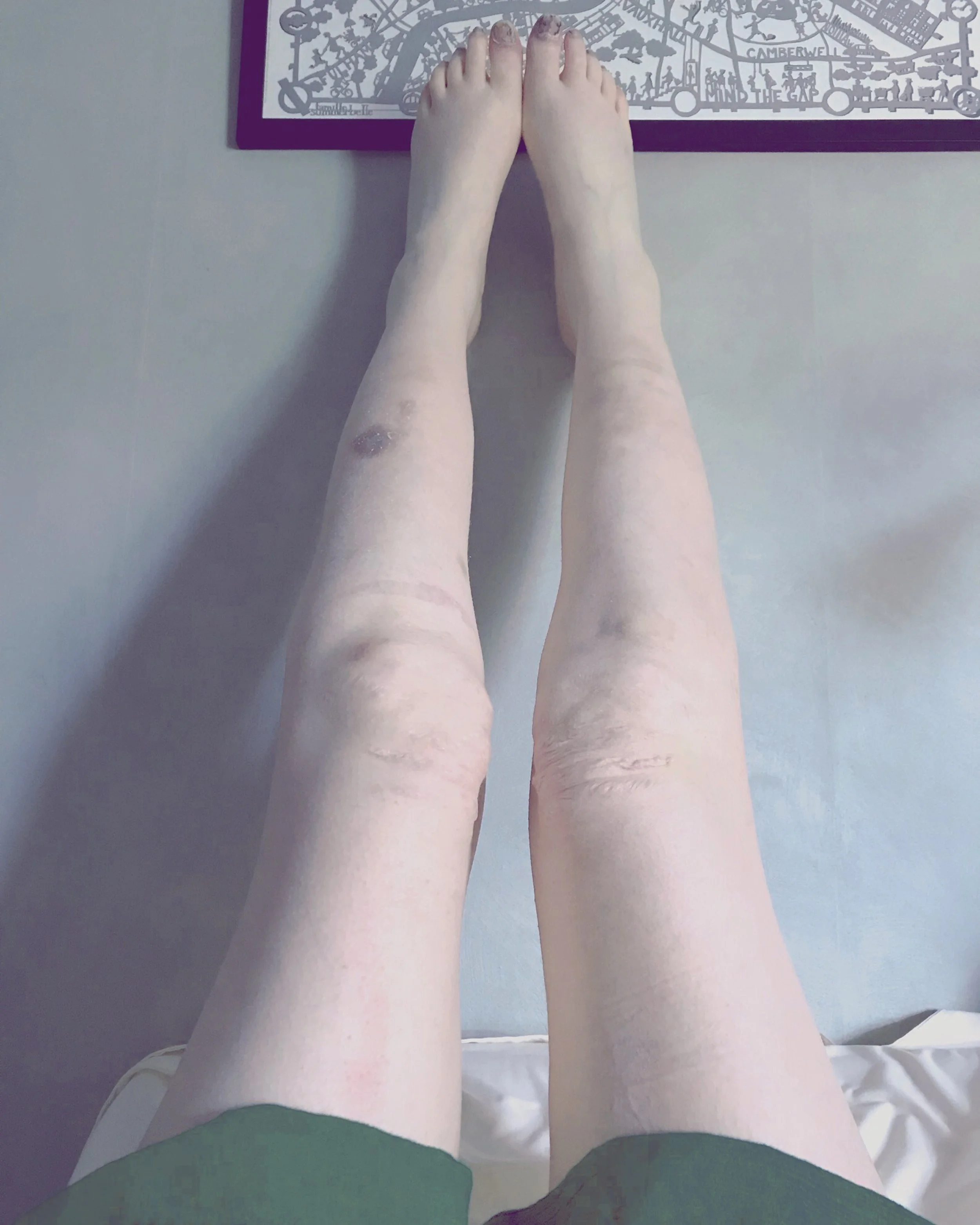 The 10th & 11th; Stupid weird kitty.