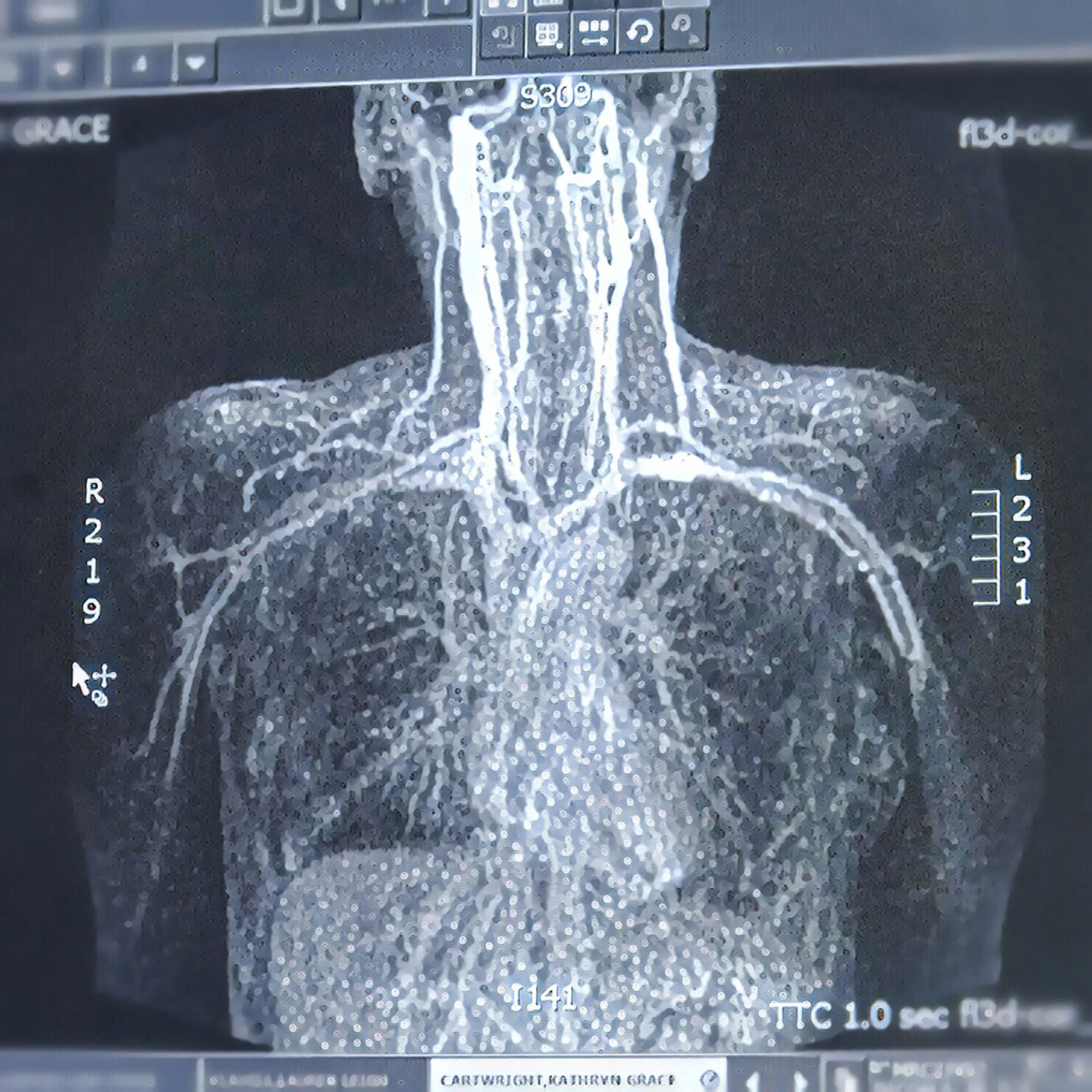 The 28th & 29th; This would be so much easier if I weren't allergic to contrast.