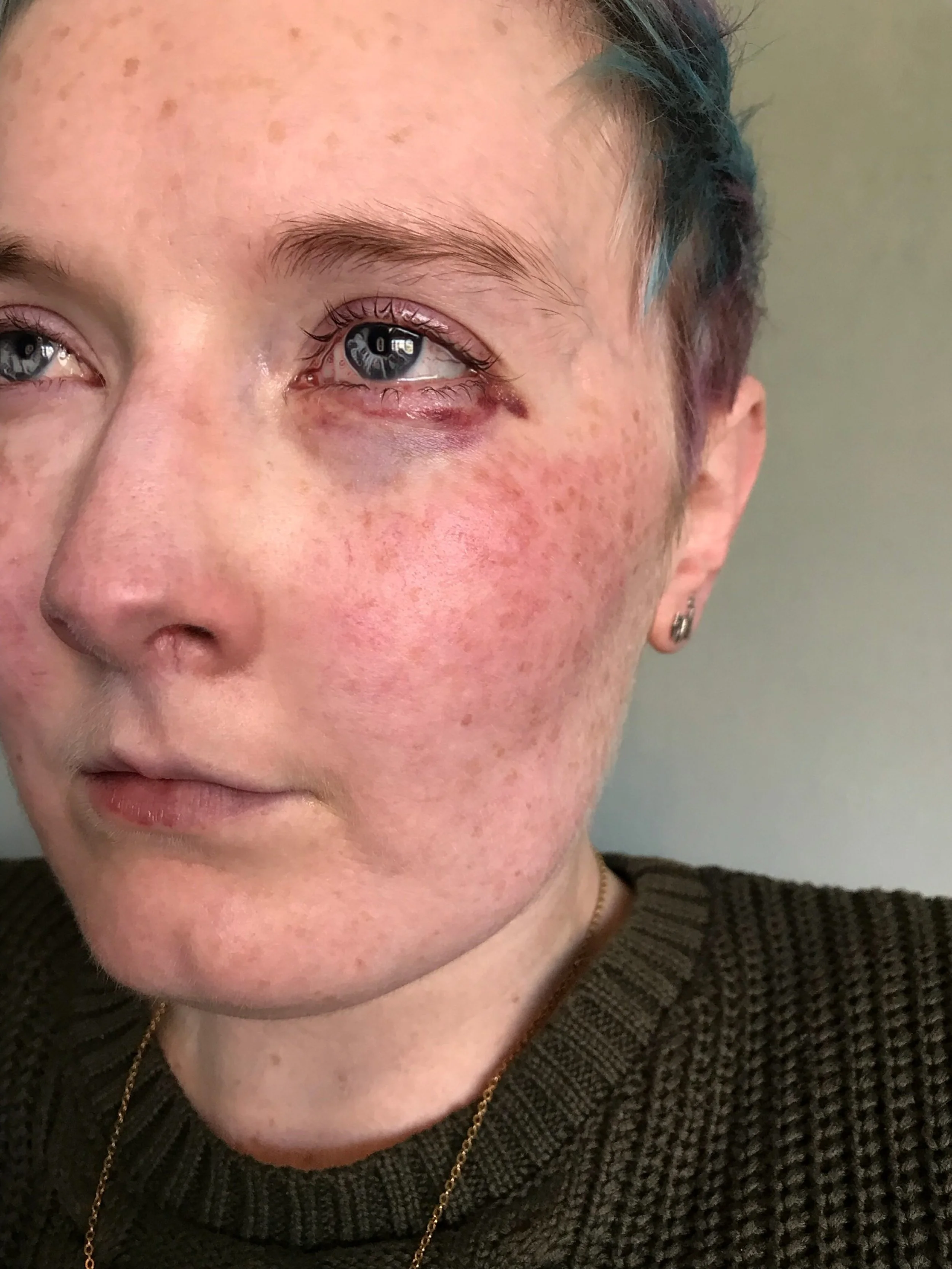 The 15th & 16th; Looks worse than it is.