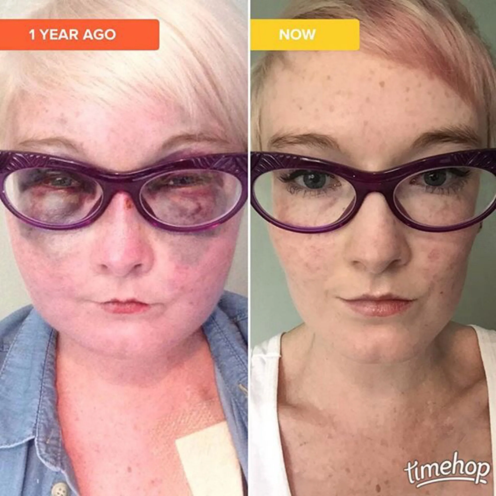 The 9th & 10th; Just not conventionally.