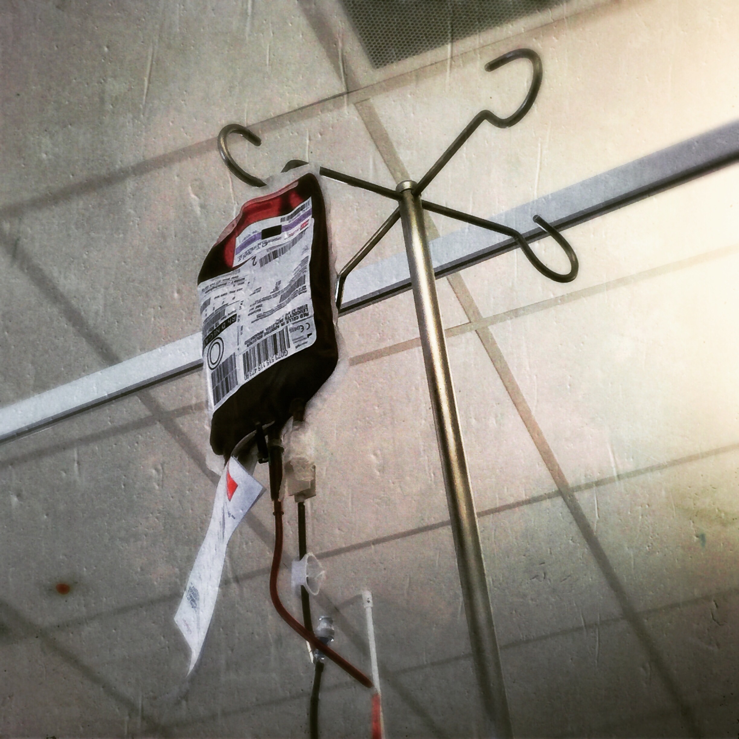 The 12th & 13th; The red lumen refused to bleed at all.