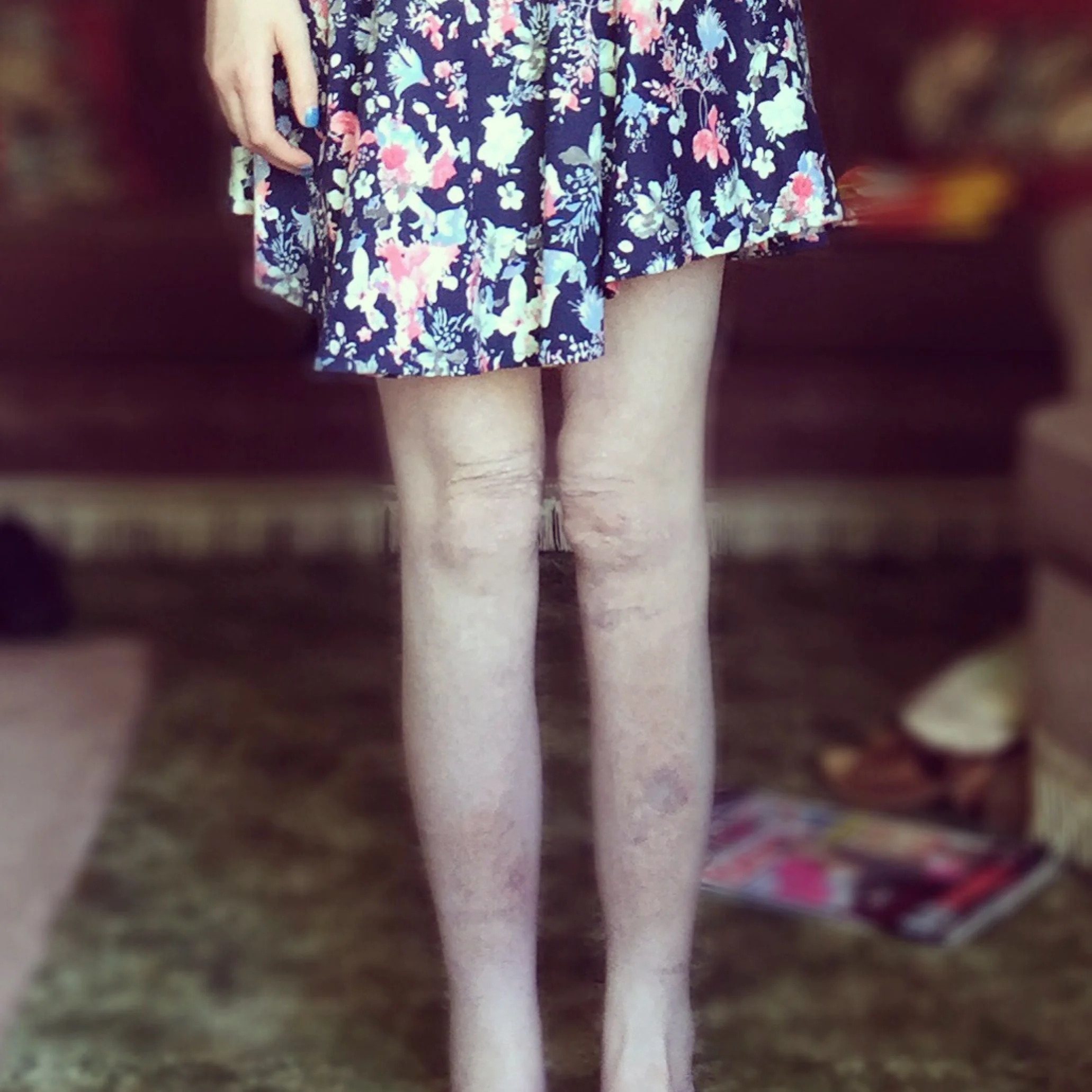 The 2nd & 3rd; More tablets to take!