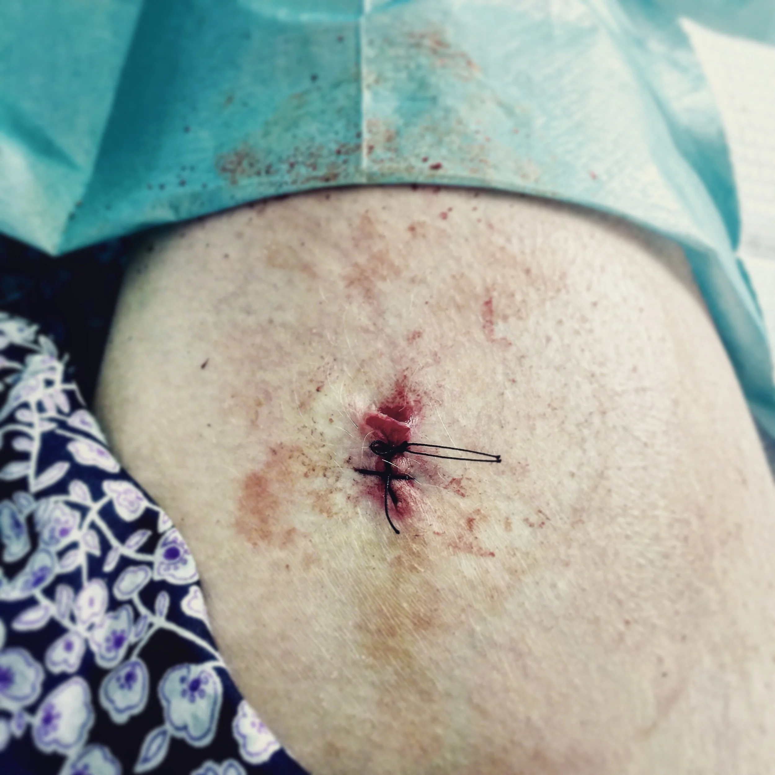 The 3rd & 4th; I am officially without plumbing!