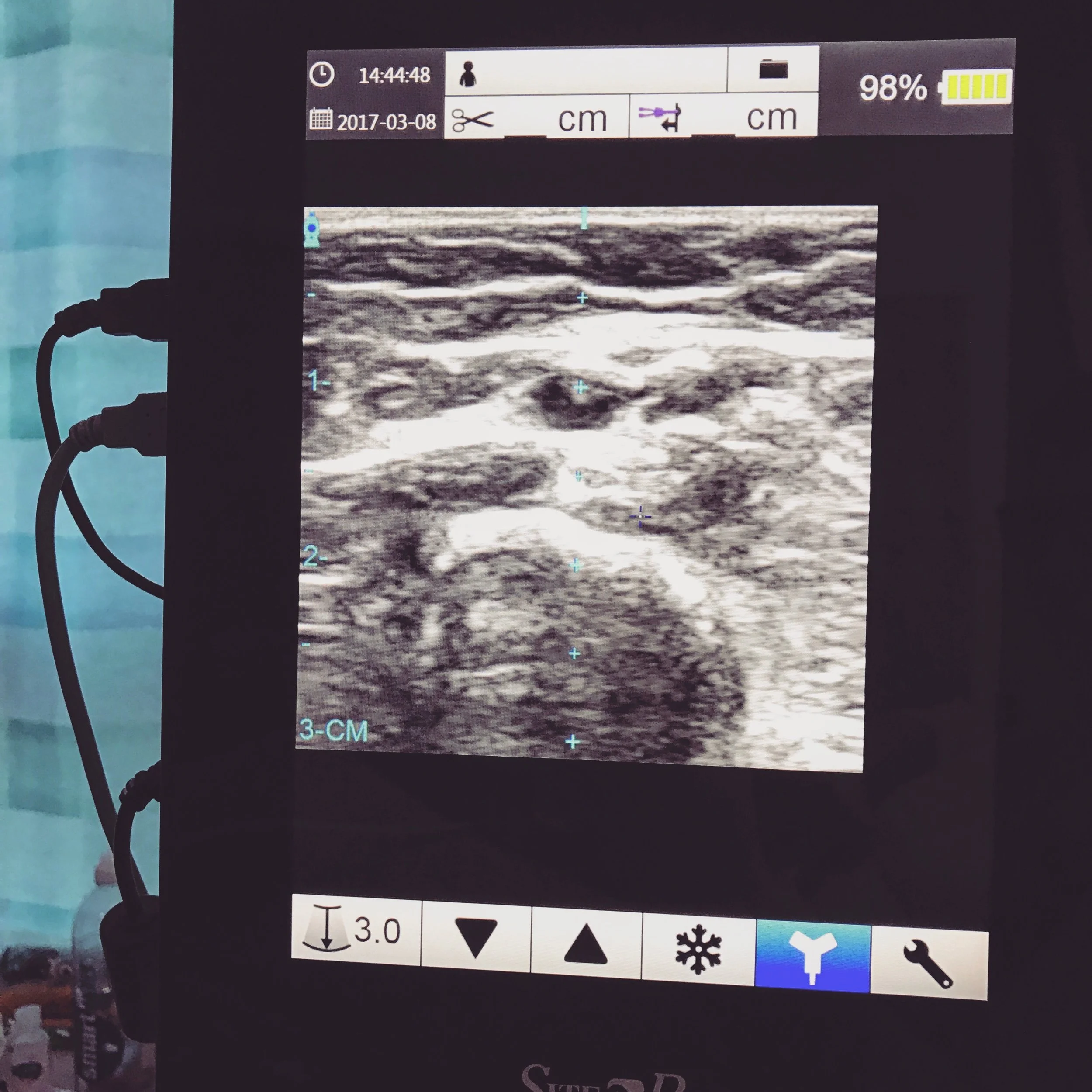 The 8th & 9th; It is the literally worst fucking thing I have ever had done to me.