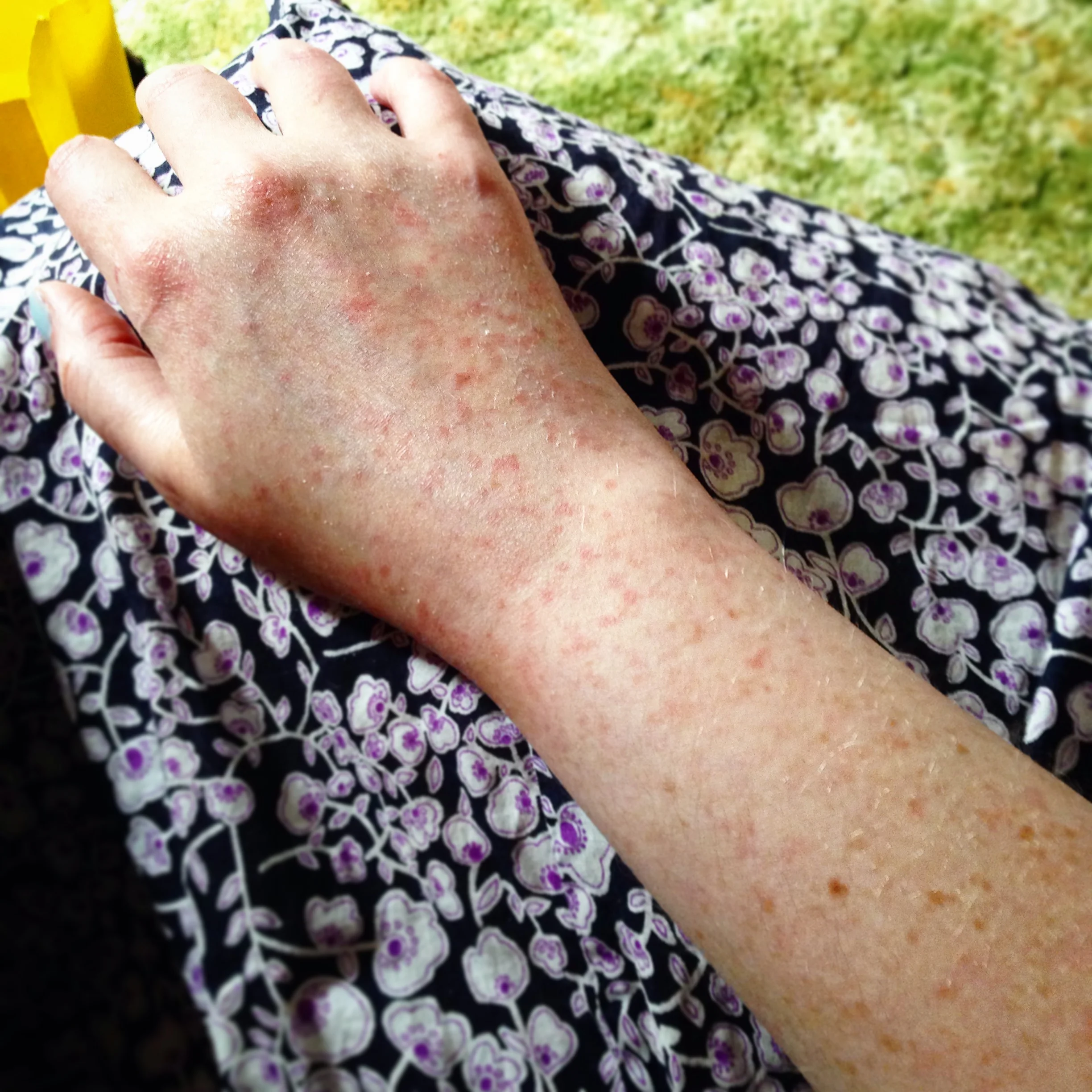 The 15th & 16th; I have to remember that I am more than just my body.