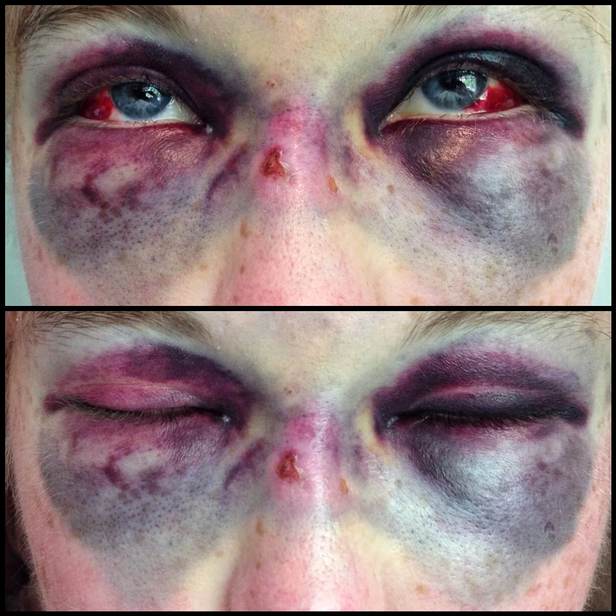 The 6th & 7th; "This is worst I can remember feeling without infection and as hard as I am trying to stay cheerful, every so often I really do just lose the will to live and I cannot carry on like this."