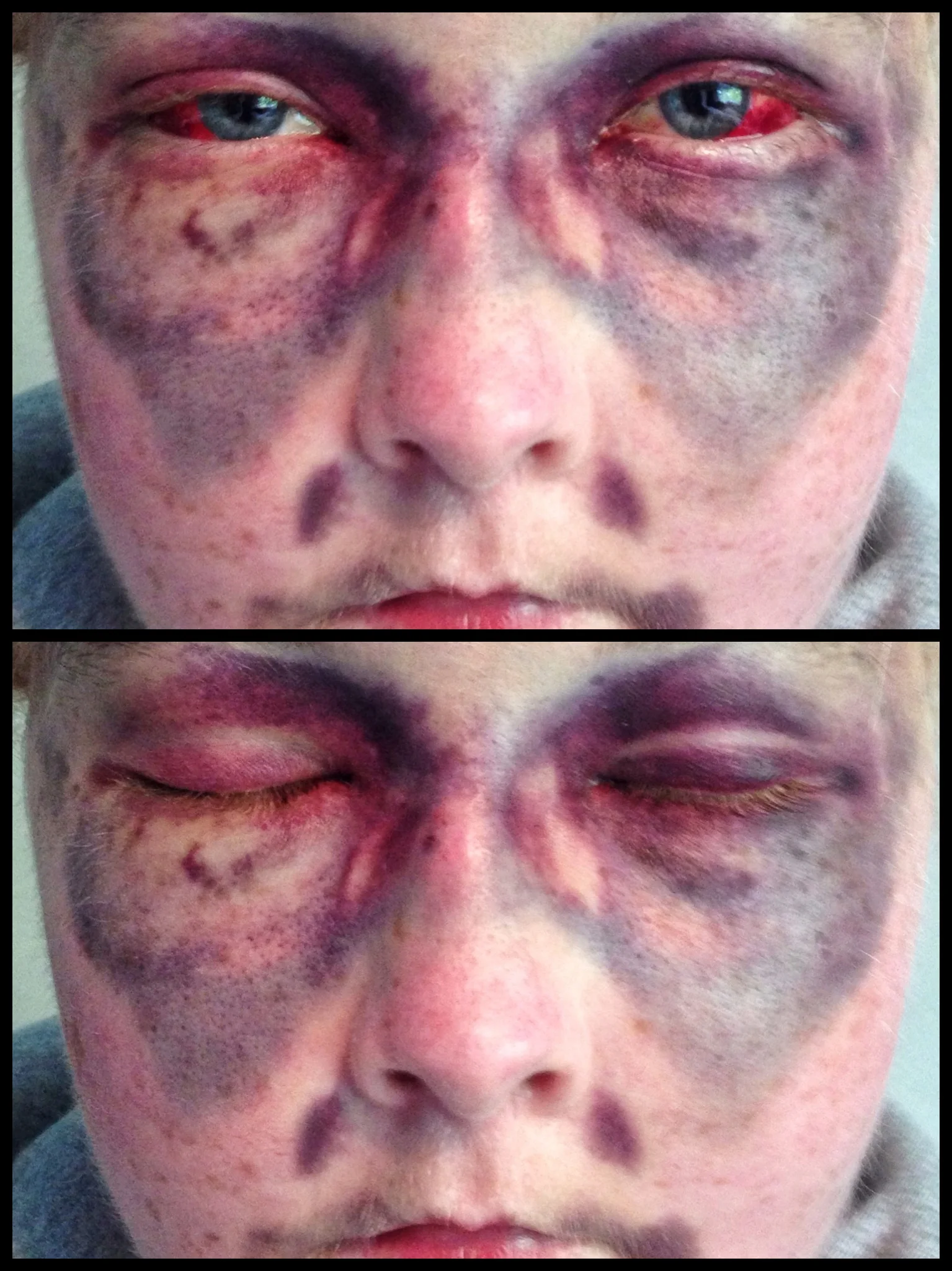 The 16th & 17th; This must be what real grief feels like.