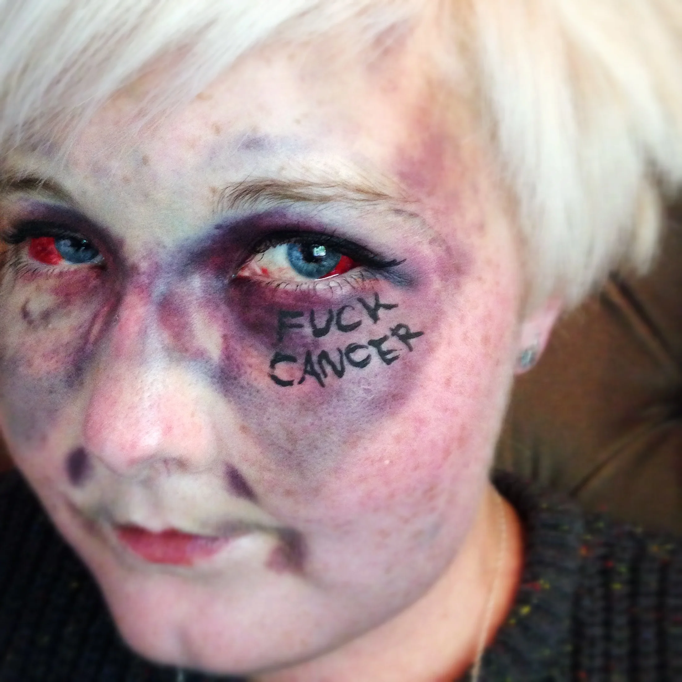 The 18th & 19th; Happy Cancerversary to me!