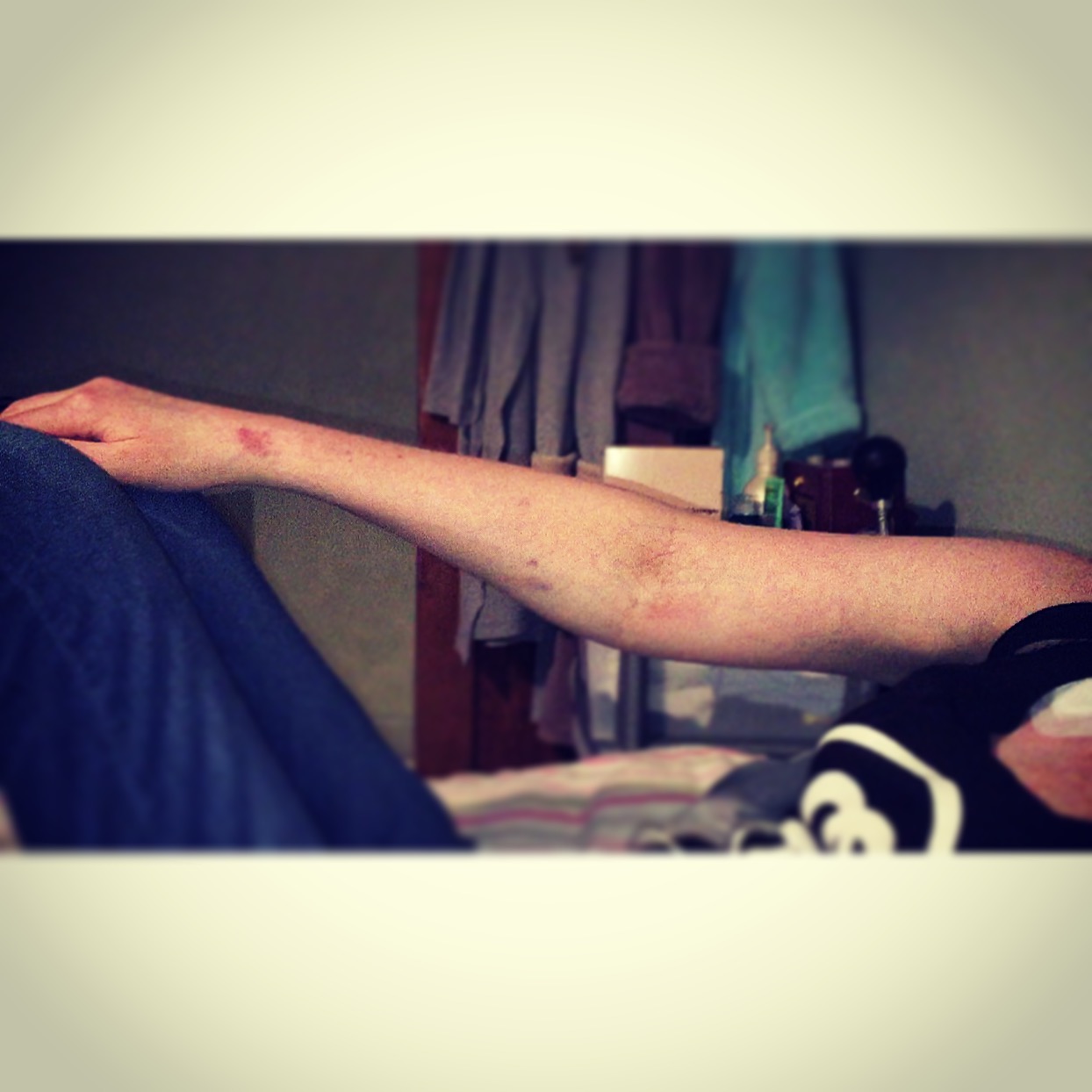 The 25th & 26th; I was not expecting to end my day in A&E.